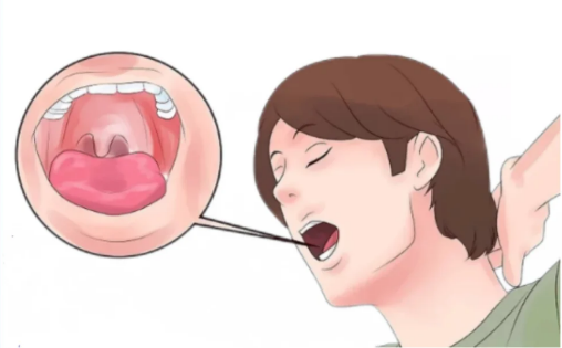 Identification of Fibroblast Related Genes as Biomarkers for Prognosis in Laryngeal Cancer Patients