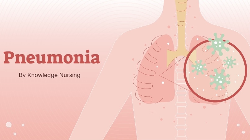 Scientists Uncover Genetic Mechanisms of Pneumonia, Confirm Causal Links of Smoking and Obesity to the Disease