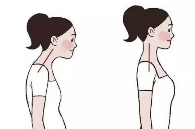 Effects of Elastic Band Resistance Training and Verbal Cueing on Musculoskeletal and Pulmonary Functions in Upper Crossed Syndrome: An 8-week Randomized Controlled Trial