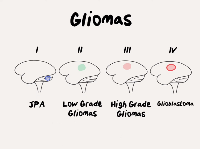 KIF11 as a Potential Diagnostic and Prognostic Biomarker for Lower-grade Glioma
