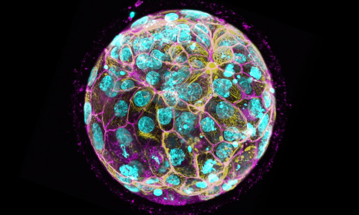 Chinese Scientists Uncover Root Cause of Frequent Human Embryo Developmental Arrest